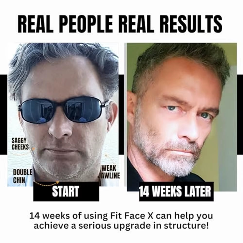 FACE SCULPTING GYM -4 Tools Working Out over 60 Face Muscles/Face Lift in a Box/Fully Sculpt Your Cheeks, Neck, Jowls, Jawline,